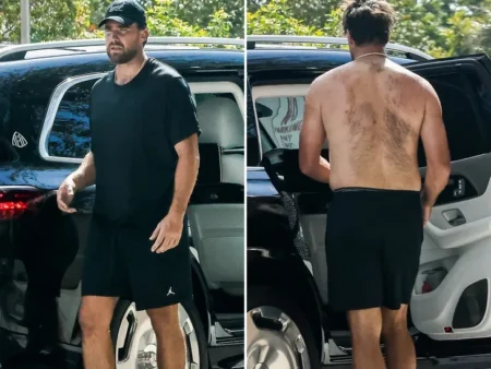 Travis Kelces Back Hair