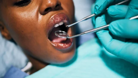 close-up-woman-mouth-hands-dental-dentist-oral-exam-teeth-cleaning