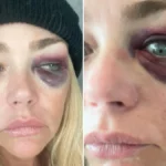 Denise Richards Granted Restraining Order After Abuse Claims