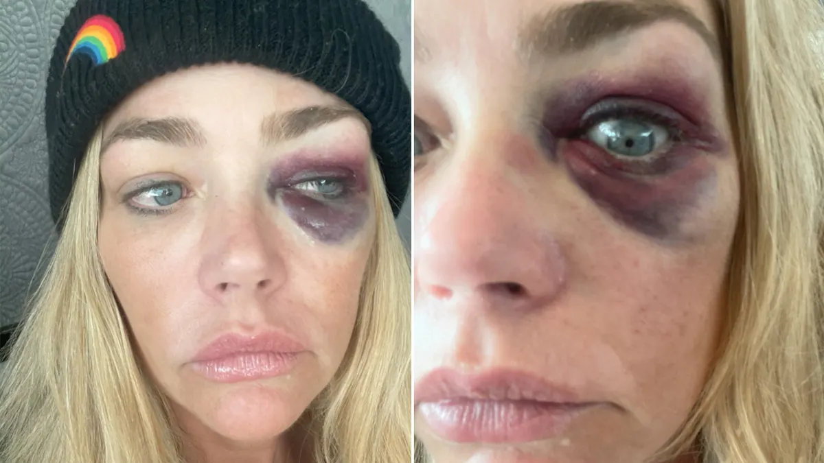 Denise Richards Granted Restraining Order After Abuse Claims
