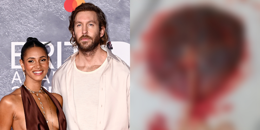 Calvin Harris Shares Baby Pics—And Wife’s Placenta