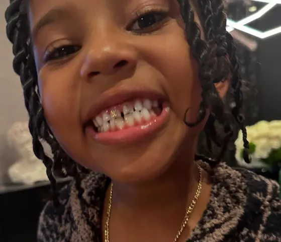 Kim Kardashians son shows off new teeth