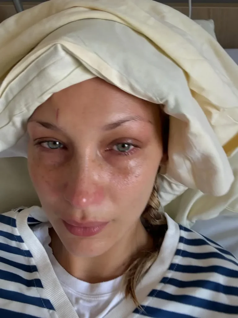 Bella Hadid Hospital Photos