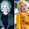 Dolly Parton Through The Years