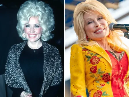 Dolly Parton Through The Years