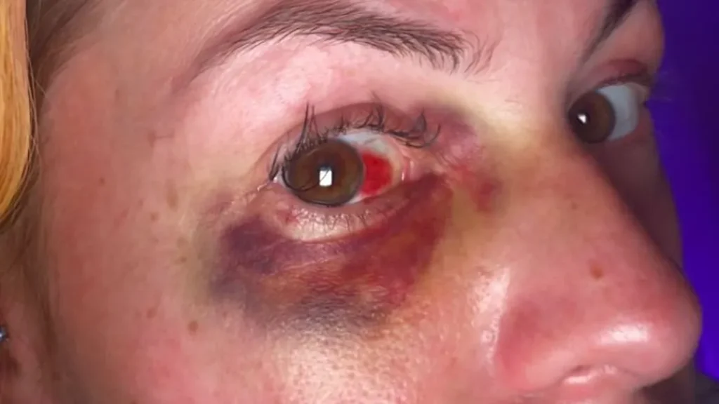 Famous Dexs Ex Shares Photos of Alleged Domestic Attack