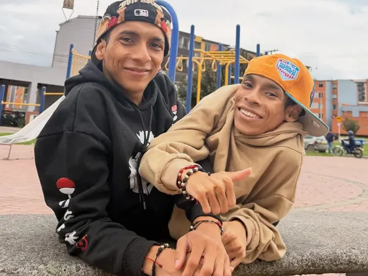 Conjoined Twin Influencers José Luis and José Armando Cevallos Die at 27 Conjoined Twin Influencers José Luis and José Armando Cevallos Dead After Heart Attack